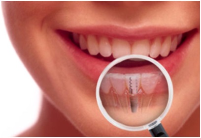 A woman with dental implants in Falls Church, VA