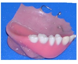 denture teeth added