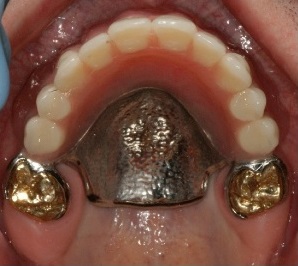 northern Virginia prosthodontist