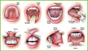 oral cancer exam prosthodontist