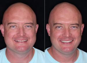 patient smile makeover