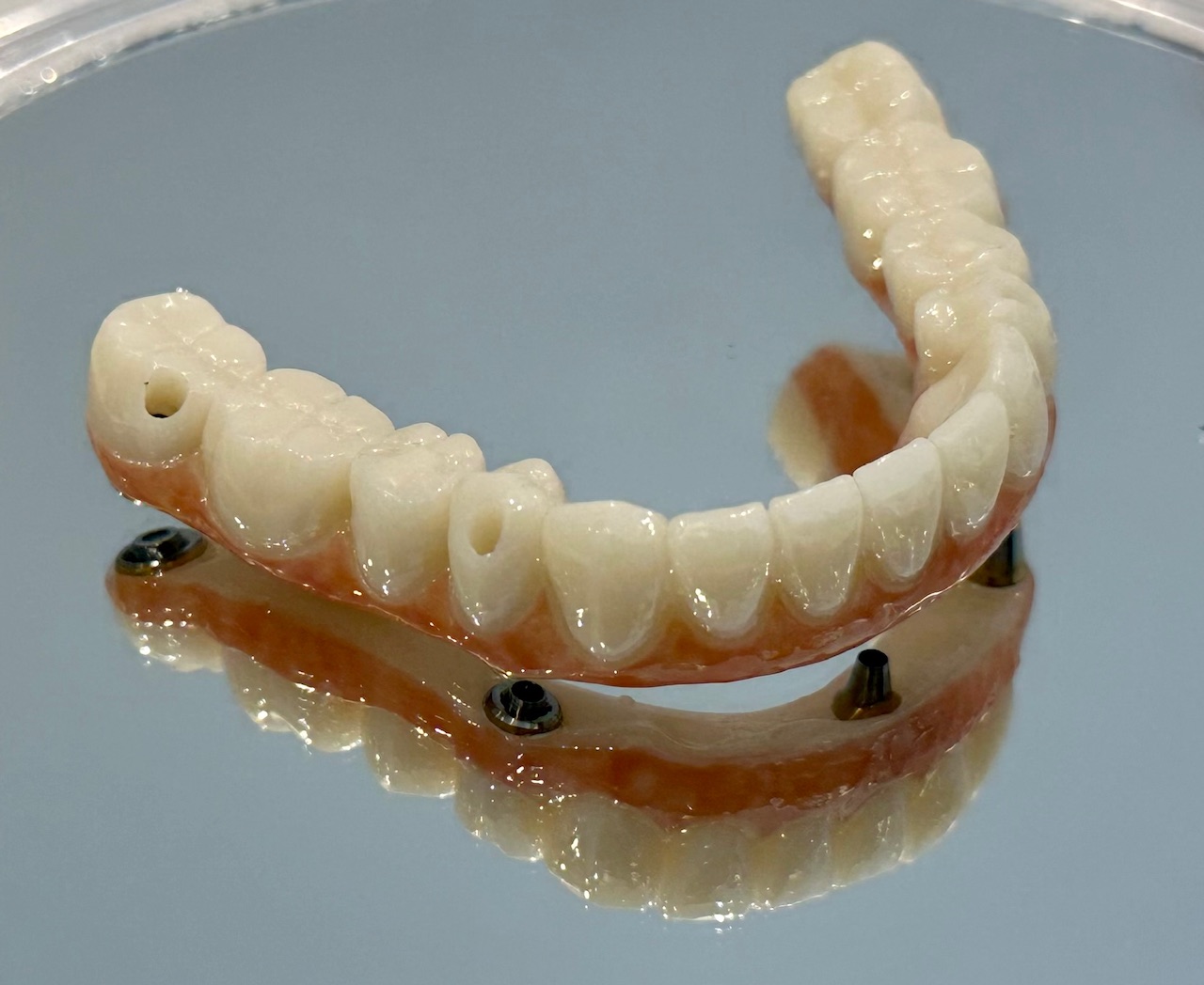 A dentist performing dental implant procedure in Fall Church VA